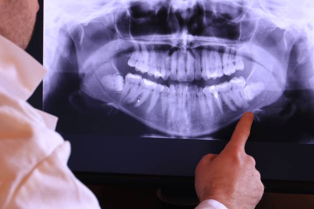 Best Emergency Denture Repair in Harvard, IL