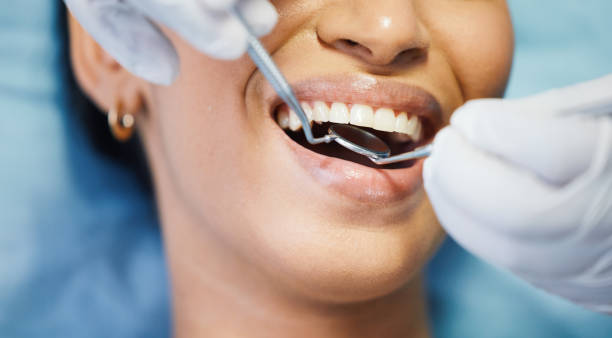 Best Emergency Dental Care for Broken or Chipped Teeth in Harvard, IL