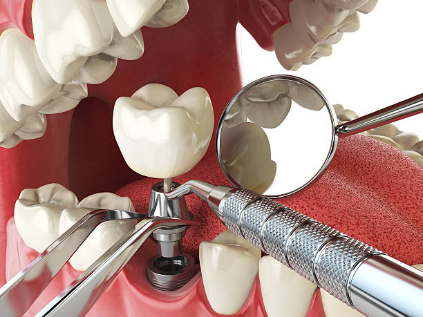 Best Emergency Treatment for Dental Infections or Abscesses in Harvard, IL